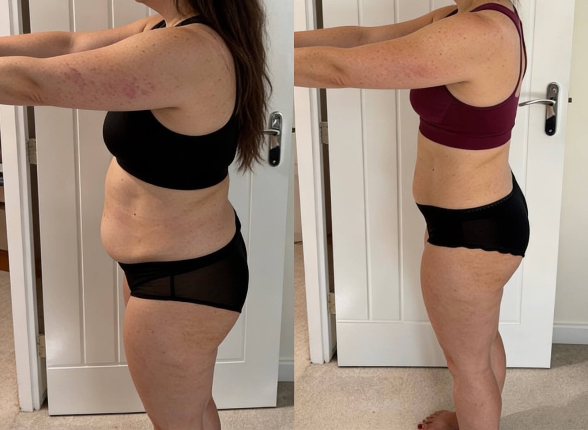 Marina: prima e dopo il percorso nutrizionale