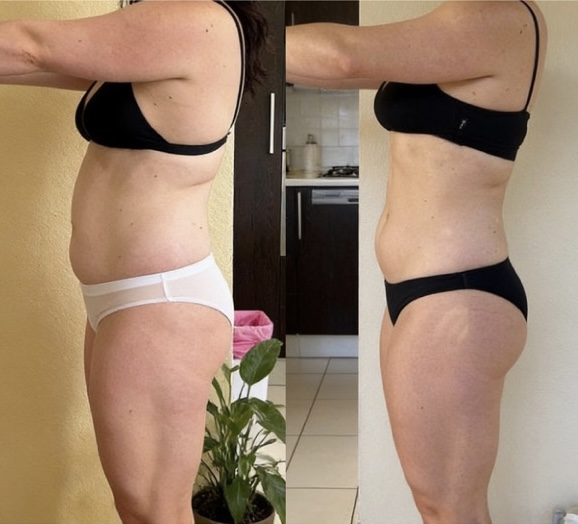 Miriana: prima e dopo il percorso nutrizionale